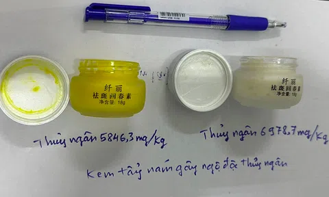 Nhiễm độc thủy ngân vì dùng kem trị nám trôi nổi