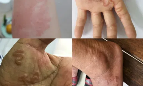 Cảnh báo nguy cơ lây bệnh từ thú cưng