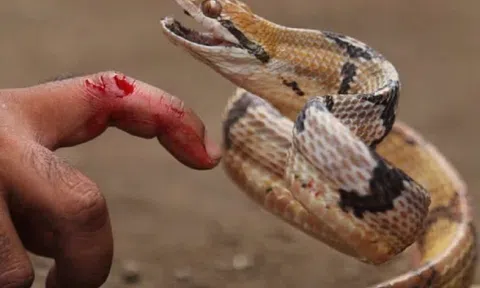 Xử trí đúng cách khi bị rắn cắn