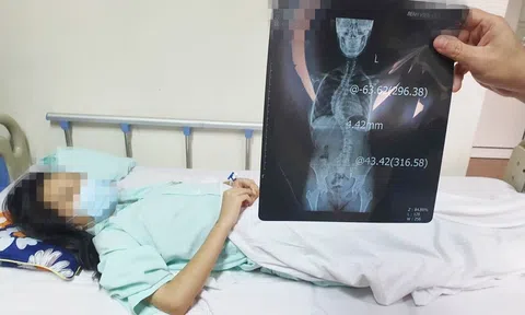 Gia tăng tỷ lệ người trẻ mắc bệnh lý cột sống